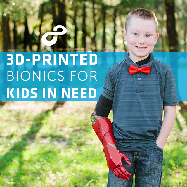 3D-Printed Bionics for Kids in Need by Stephanie Valderrama - Indiegogo